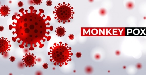 Първи починал от маймунска шарка в Съединените щати Според департамента